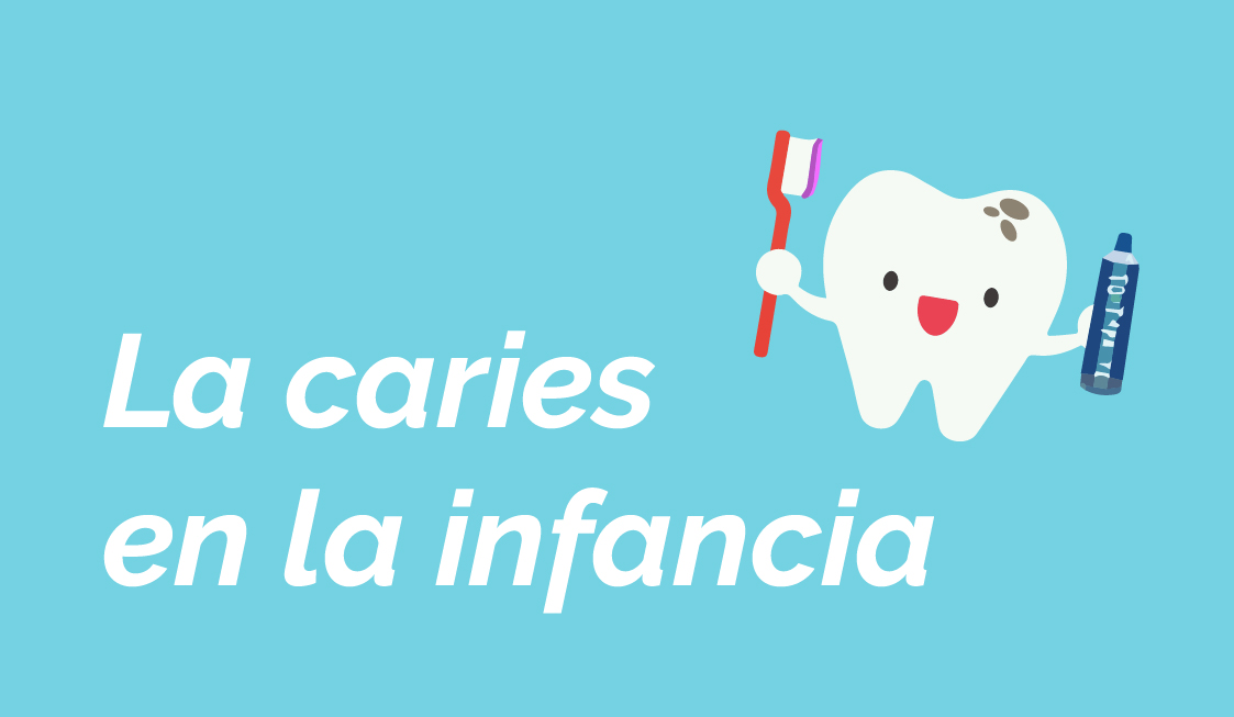 Caries: el principal problema dental infantil