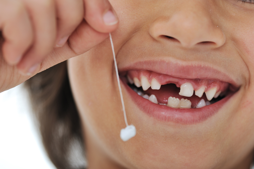 ¿Cómo y cuando extraer los dientes de leche?