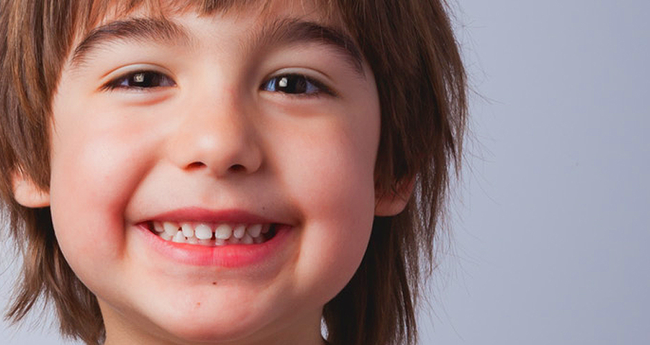 Microdoncia y macrodoncia en niños