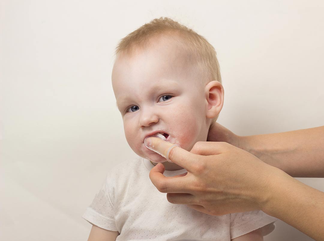 Preguntas: odontología para bebes