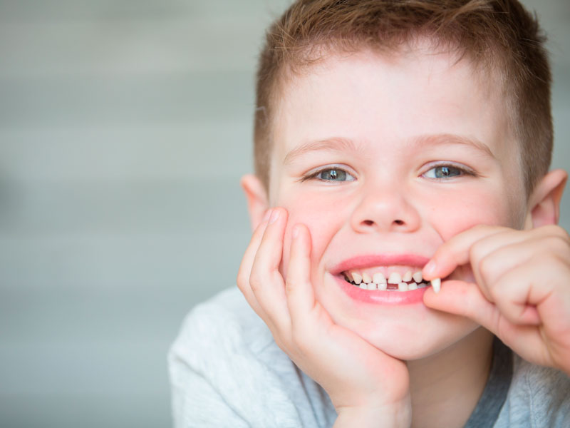 Dientes temporales: caída y precauciones