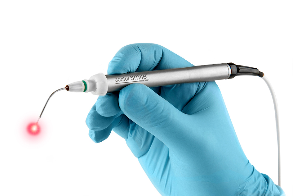 Láser dental ventajas en Odontopediatría