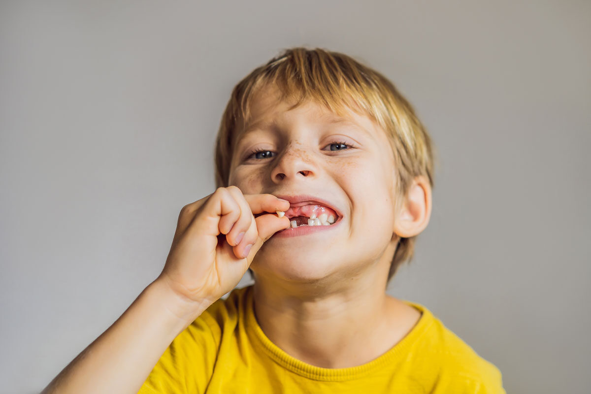 Lesiones dentales, ¿qué hacer?